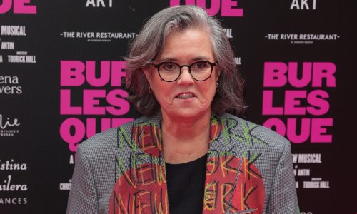 Platila je više nego za auto: Rosie O'Donnell progovorila o tajnom estetskom zahvatu