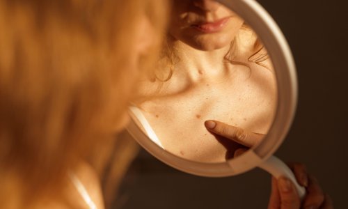 Znanstvenici s Ruđera došli do važnog otkrića o širenju melanoma
