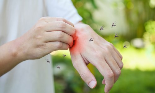 Neugodan virus ruši rekorde po Europi: Pojavio se u državama gdje ga dosad nije bilo