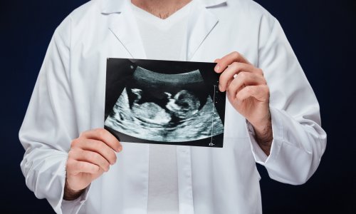 Alarmantno otkriće: Mikroplastika prolazi kroz posteljicu i može utjecati na hormone u trudnoći