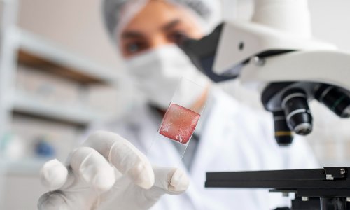 Znanstvenici oglasili uzbunu: Pronađen mutirani soj gljivice koja je otporna na lijekove