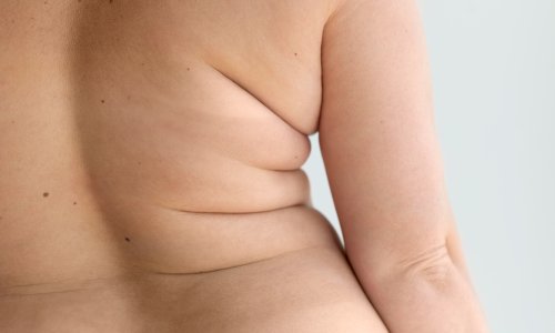 Jedna vrsta masti u tijelu mogla bi imati važnu ulogu i u mentalnom zdravlju
