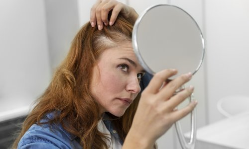 Sijede vlasi pojavile su vam se ranije nego što ste očekivali? Dermatolozi otkrivaju moguće razloge