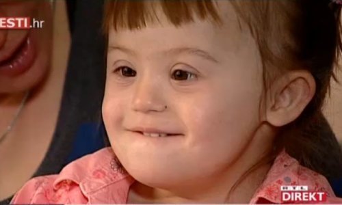 Ukinuta pomoć djevojčici s Downovim sindromom