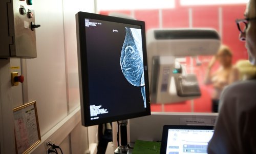 Odobren novi inovativni lijek za uznapredovali rak dojke