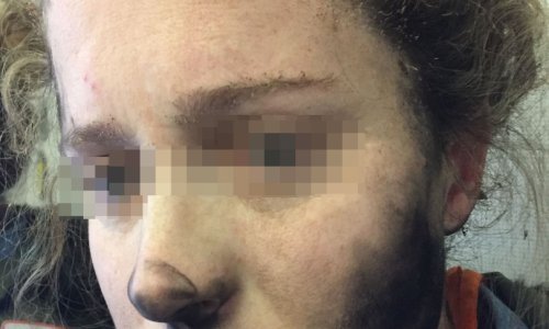 Ovoj su se ženi slušalice zapalile na glavi. U avionu