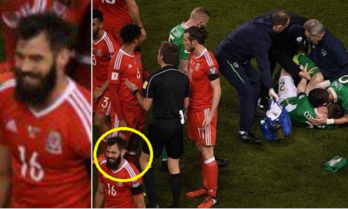 Smijao se teško ozlijeđenom Ircu, a onda kritičare poslao psihijatru