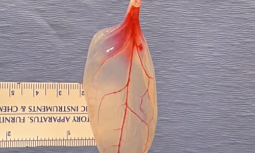 Od lista špinata s tržnice moguće je napraviti potpuno funkcionalno srčano tkivo!