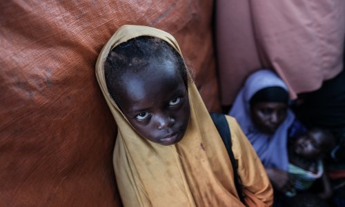 Zašto je u novom mileniju moguća strašna epidemija gladi?