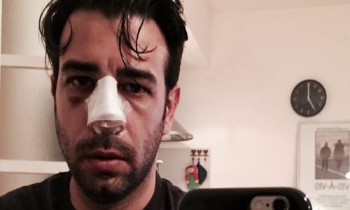 Tko je razbio nos Janku Popoviću Volariću?