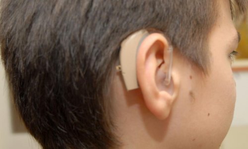 HZZO ukida besplatne baterije za slušne aparate