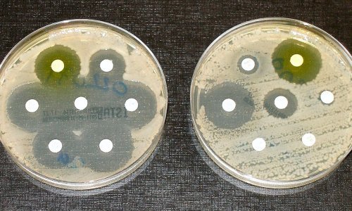 Australska studentica otkrila kako ubiti superbakterije bez antibiotika