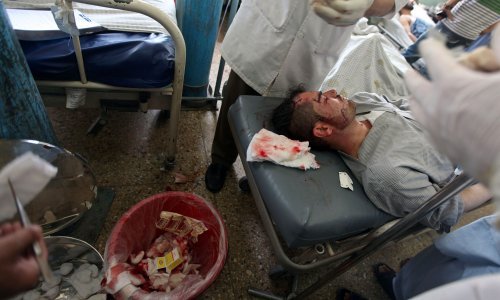 U Kabulu u terorističkom napadu najmanje 80 ubijenih i 350 ranjenih