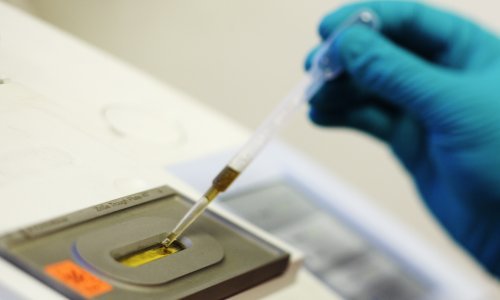 Deset zemalja srednje i istočne Europe zajedno u borbi protiv raka