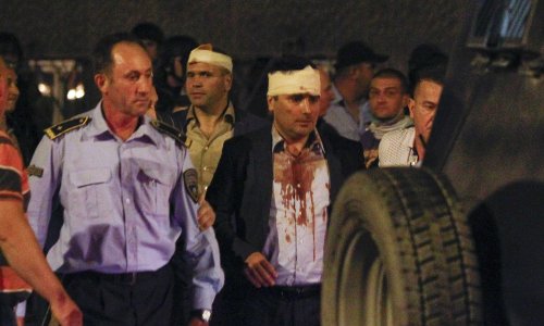 Policija rastjerala razjarenu masu iz parlamenta, šef albanske stranke teže ozlijeđen