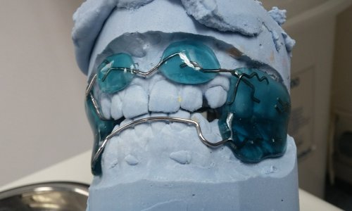 Kakav lik! Uz pomoć 3D printera popravio zube za 60 dolara