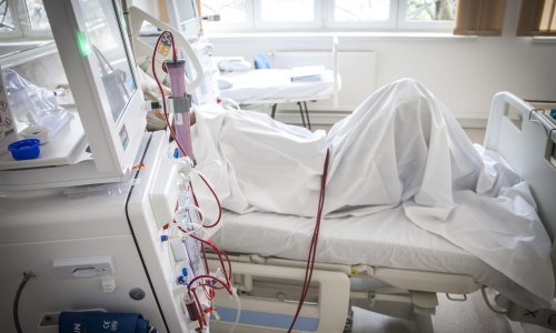 KBC Split dobio novi sustav za dijalizu vrijedan 1,5 milijuna kuna