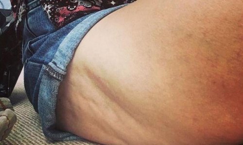 Pokazala celulit i postala još slavnija