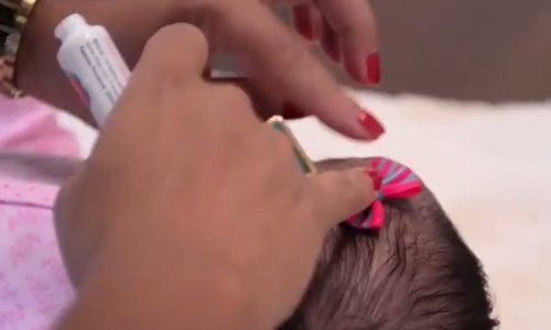 Dilemu 'curica ili dečko' rješavaju ljepilom za bebinu glavu