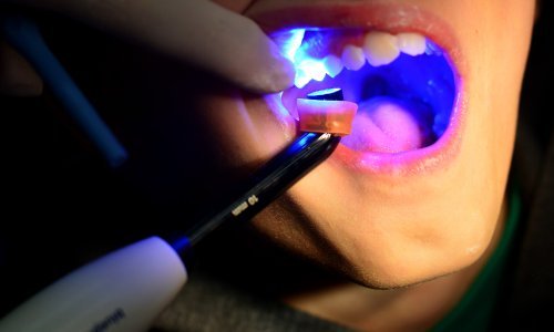 Zubarima promet raste u nebo, ovo je deset najjačih