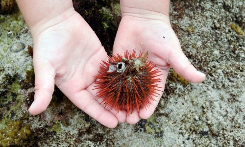 Liječnici savjetuju: Što činiti kod otrovnih uboda, ugriza i opeklina na ljetovanju