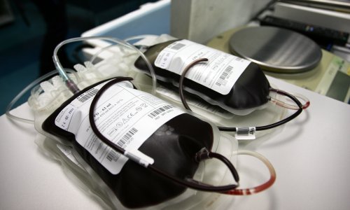 Apel iz splitskog KBC-a: Nedostaje nam svih krvnih grupa