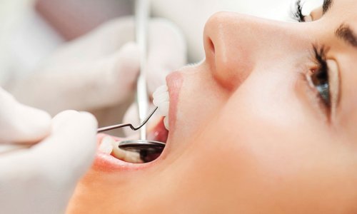 Upoznajte najvećeg neprijatelja vaših zuba i doznajte kako ga pobijediti