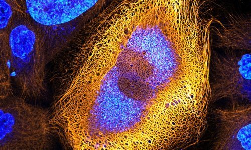 Mikroskopski svijet je čaroban, a ovo je 20 najboljih fotografija u 2017. godini