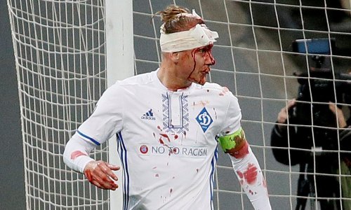 Vida zaradio 10 šavova na glavi i upitan je za ukrajinski derbi