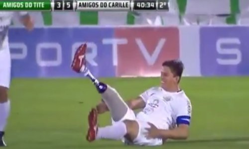 Izgubio je nogu, ali ne i smisao za humor; zna se našaliti na svoj račun