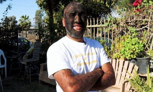 Upoznajte Larryja Gomeza – najdlakavijeg čovjeka na svijetu