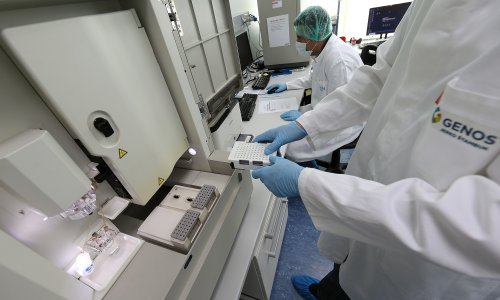 Genosov test biološkog starenja može predvidjeti desetogodišnji rizik za nastanak kardiovaskularnih bolesti