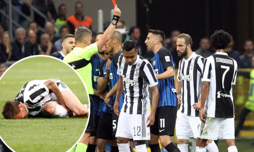 Procurile fotografije Mandžine noge; nogometna javnost zgožena da je i dalje igrao s takvom ozljedom