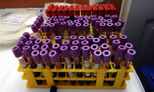 Krv u venama nikada nije plava