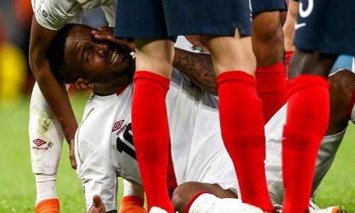 Šokantna ozljeda peruanske zvijezde: Bila je to stravična scena...