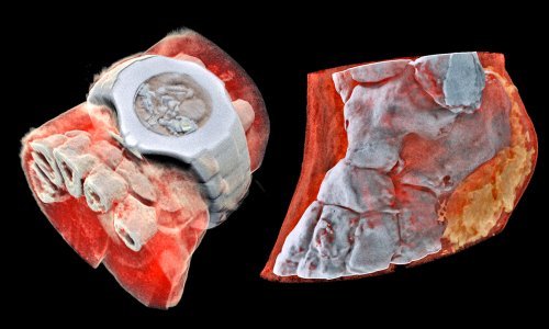 Stigao je prvi 3D rendgenski uređaj koji snima slike u boji