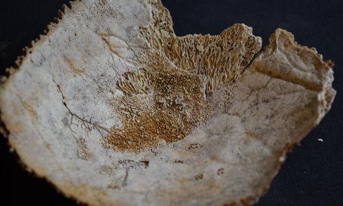 Svjetska krema paleopatologije stiže u Zagreb na 22. europski kongres