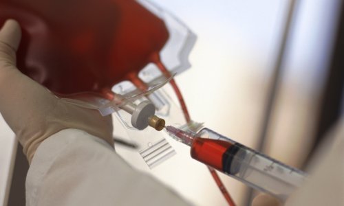 Mladi Beograđanin: Zašto Hrvatska ne želi moju krv?