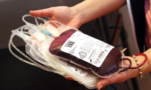 Nedostaje krvi u bolnicama, odgađaju se tzv. hladne operacije