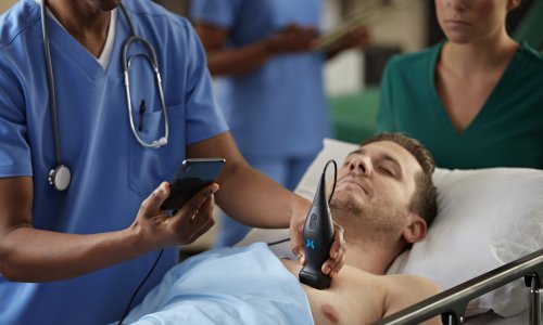 Ultrazvuk koji možete napraviti sami? I to je moguće uz ovaj uređaj