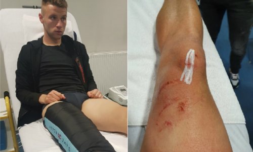 Bjelica bijesan, Dinamo otkrio ružne posljedice osporavanog penala