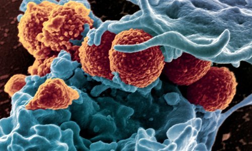 Upravljači u automobilima prljaviji su od zahodske školjke