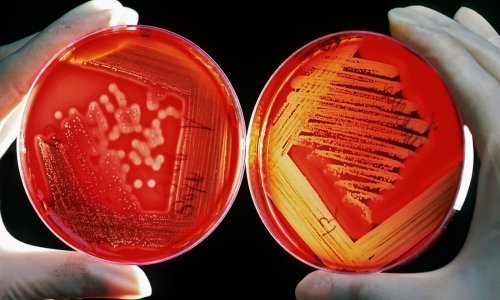 Najnovije istraživanje moglo bi promijeniti način na koji možemo otkriti rak, ali i kako ga liječimo, i sve to zbog gljivica