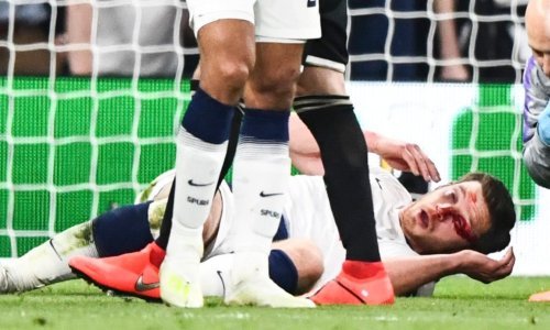 Užas u Londonu; strašan sudar nogometaša u kojem je najgore prošao Jan Vertonghen