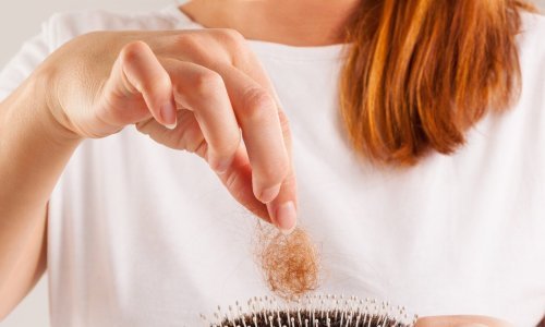 U Hrvatsku je stigao revolucionaran test za ćelavost: Evo kako funkconira i koje su njegove prednosti