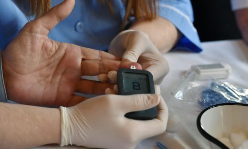Vlada je izigrala zaposlenike u sustavu zdravstva