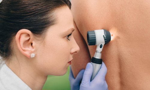 U Hrvatskoj gotovo 1.000 osoba oboli od melanoma, svi ste pozvani na besplatan pregled