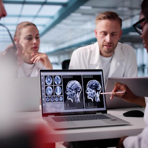 Stvoren prvi atlas ljudskog mozga: Ključ za razumijevanje autizma i shizofrenije?