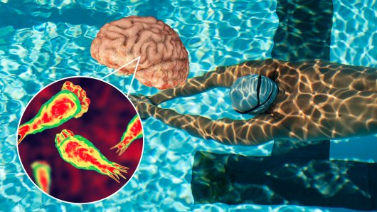 SMRTONOSNA INFEKCIJA