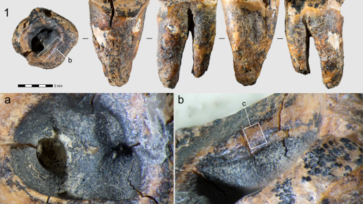 Znanstvenici imaju dokaze: Neandertalci su prije 59 tisuća godina imali - zubare